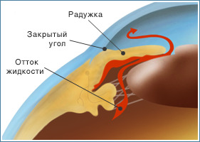 http://sc002.ucoz.ru/zakr_glaukoma.jpg